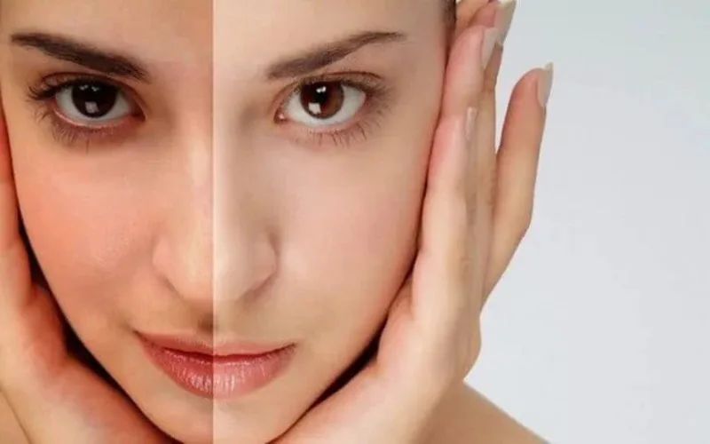Bí quyết cải thiện làn da xỉn màu nhanh chóng và an toàn