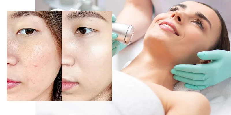 4 cách làm đẹp da mặt từ thiên nhiên tập trung làm dịu và bảo vệ hàng rào da.